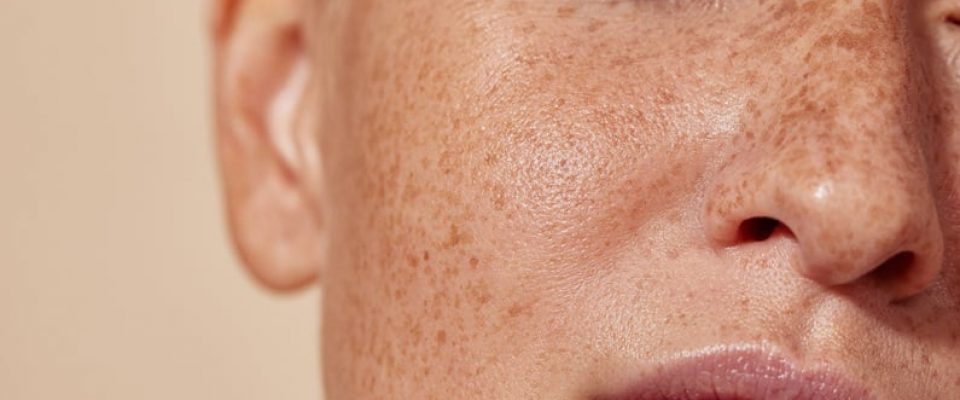 Moderne Faltenebhandlung